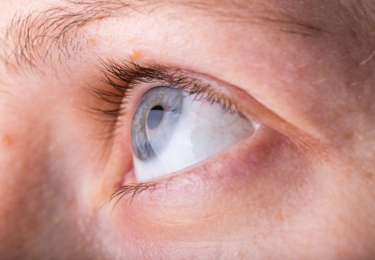 Close up eye