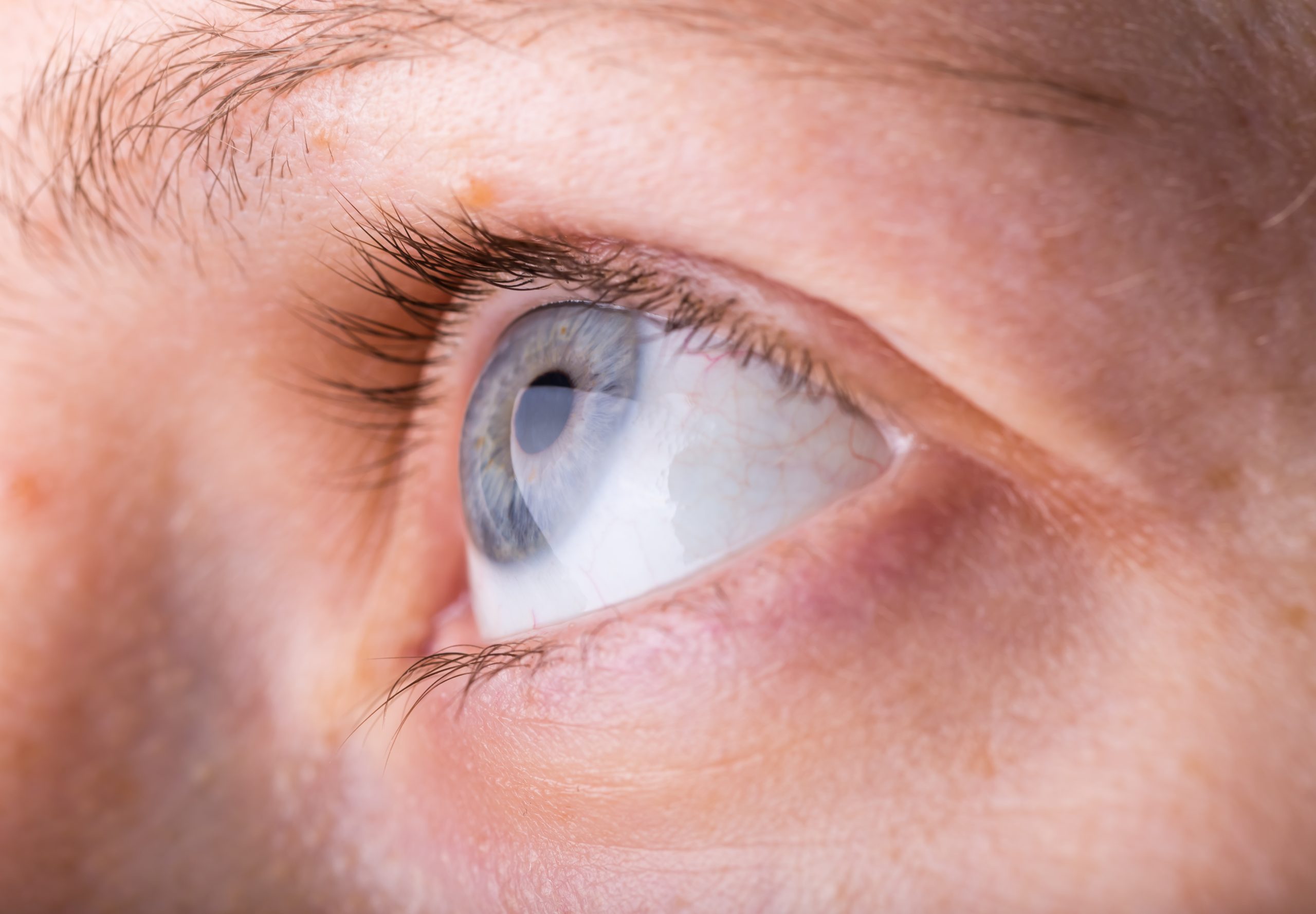 Close up eye